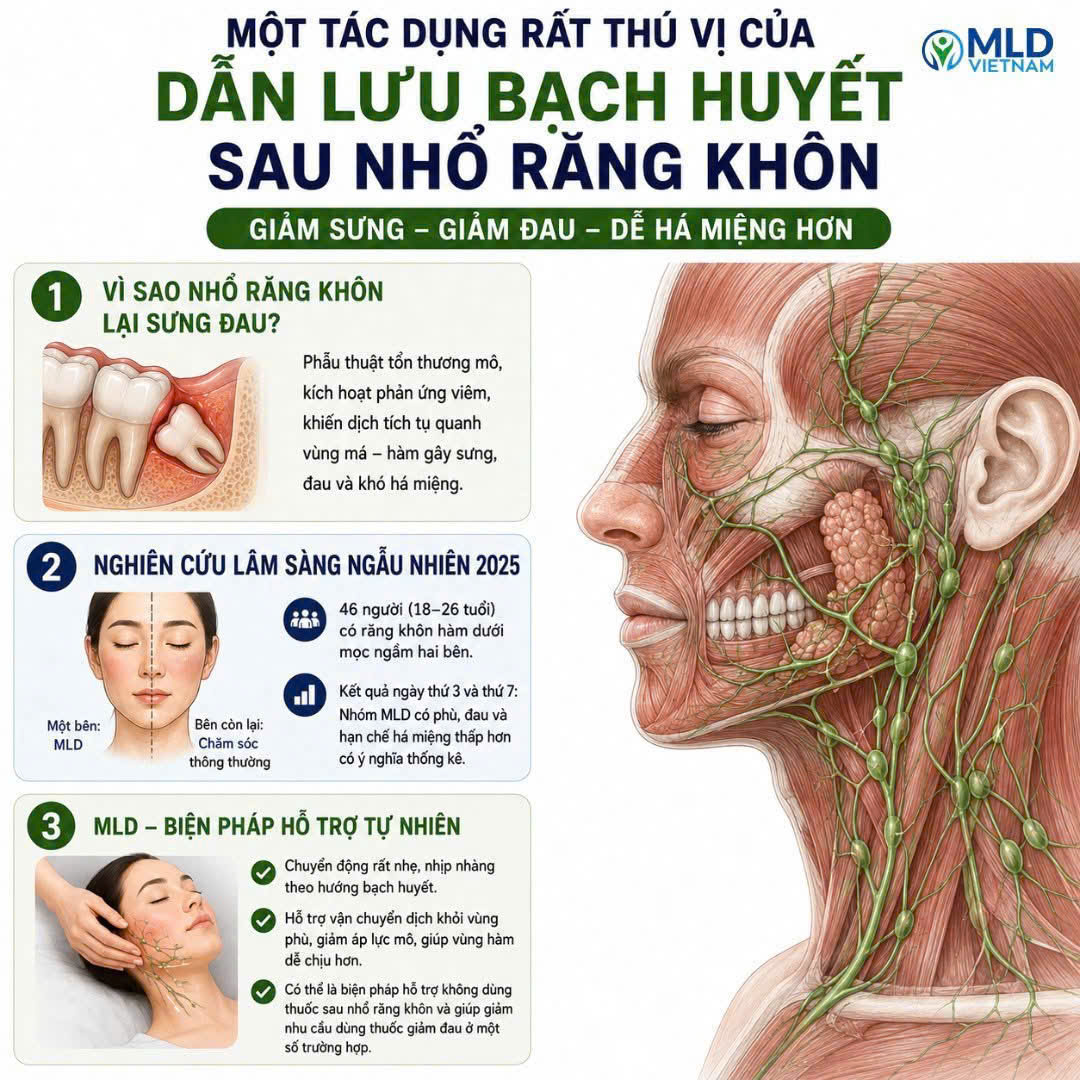 Một tác dụng thú vị của dẫn lưu bạch huyết sau nhổ răng khôn: giảm sưng - giảm đau - dễ há miệng hơn