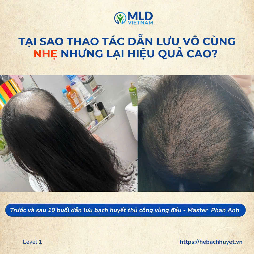Tác dụng của dẫn lưu bạch huyết vùng đầu đối với TÓC và da đầu
