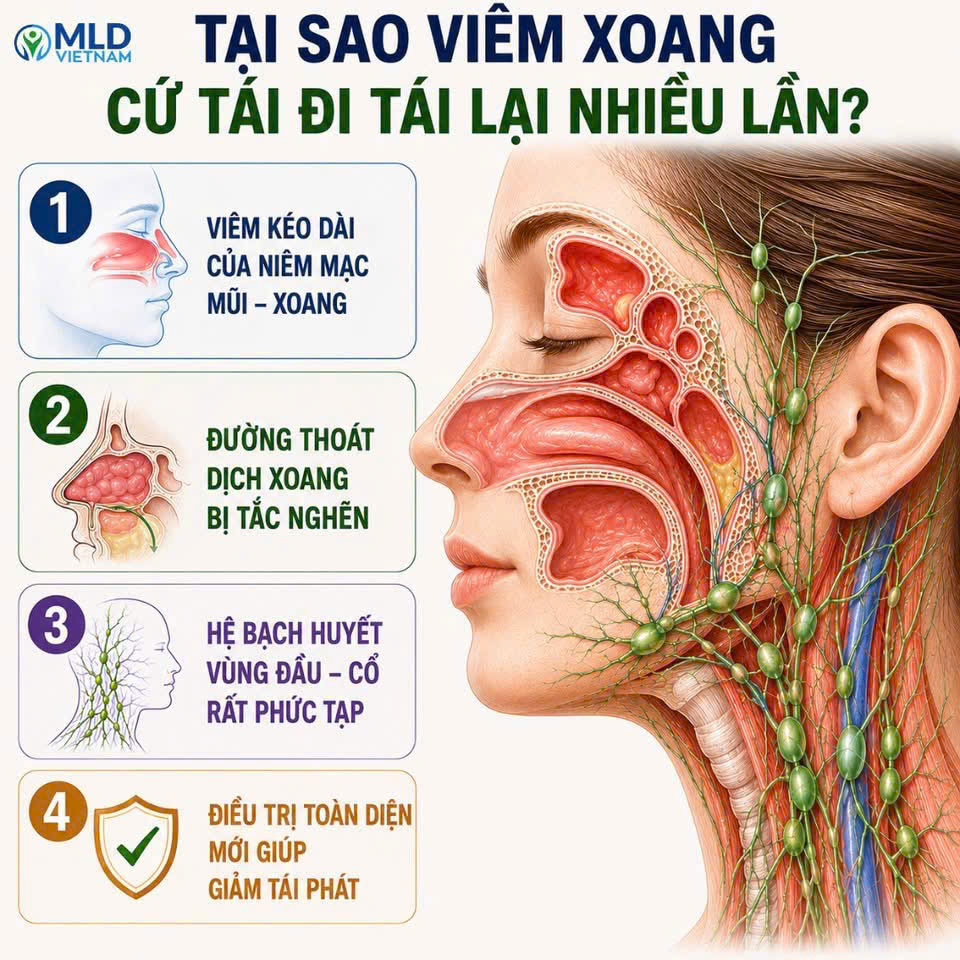 Tại sao viêm xoang cứ tái đi tái lại nhiều lần?
